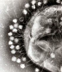 Electron micrograph of phages