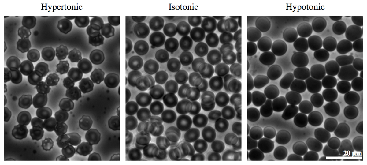 Red blood cells can shrivel or burst if their environment changes tonicity. Image from Wikimedia user Zephyris