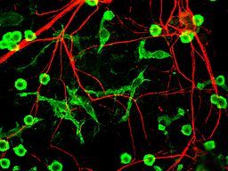 Neurons and microglial cells stained red and green respectively.